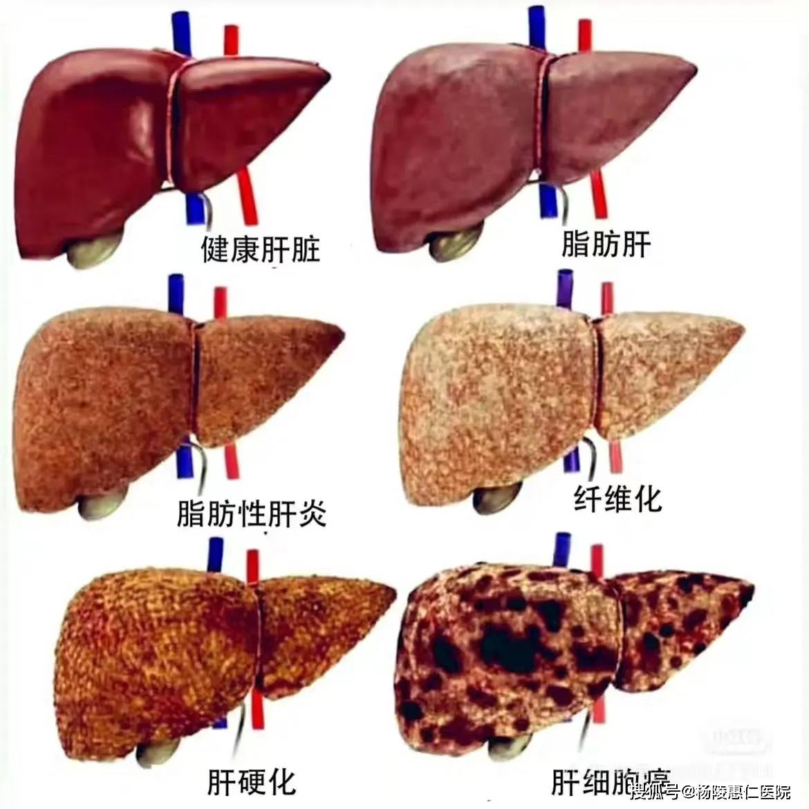 康缘药业：公司参股或控股子公司目前暂未开展脑部疾病的筛查、诊断和康复治疗相关业务