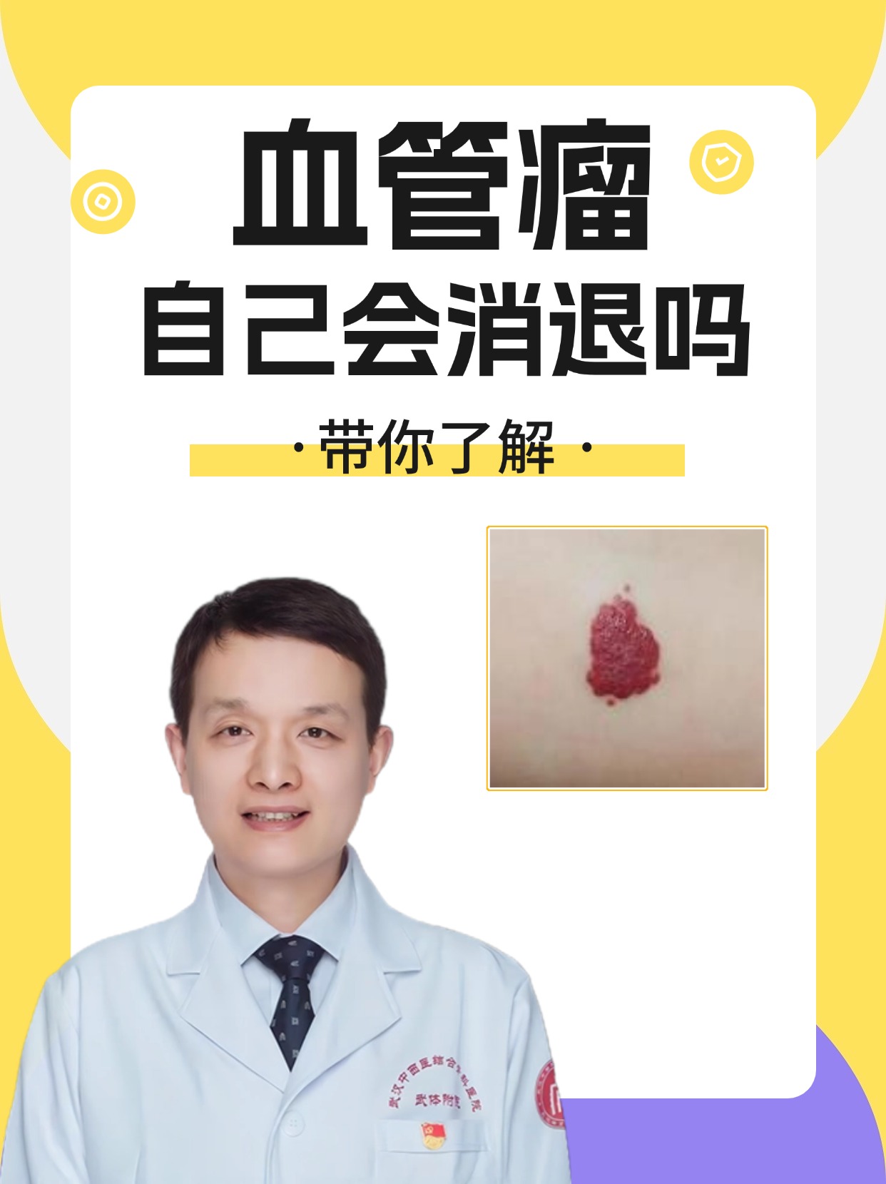 阿里健康首发:婴儿血管瘤外用原研药贝美净®马来酸噻吗洛尔凝胶